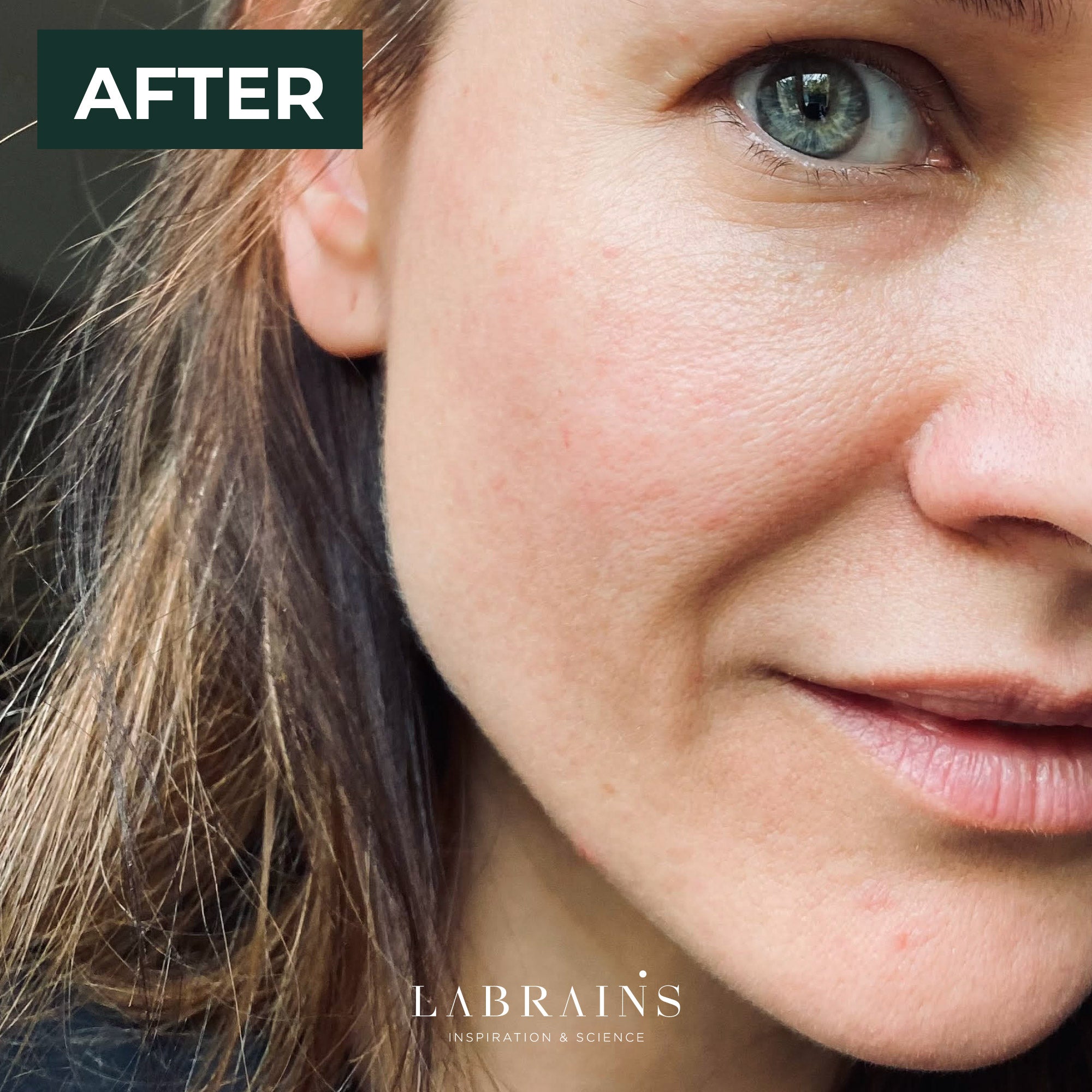 Liga Brunina, founder of LABRAINS, with clear skin after developing and using labrains skincare