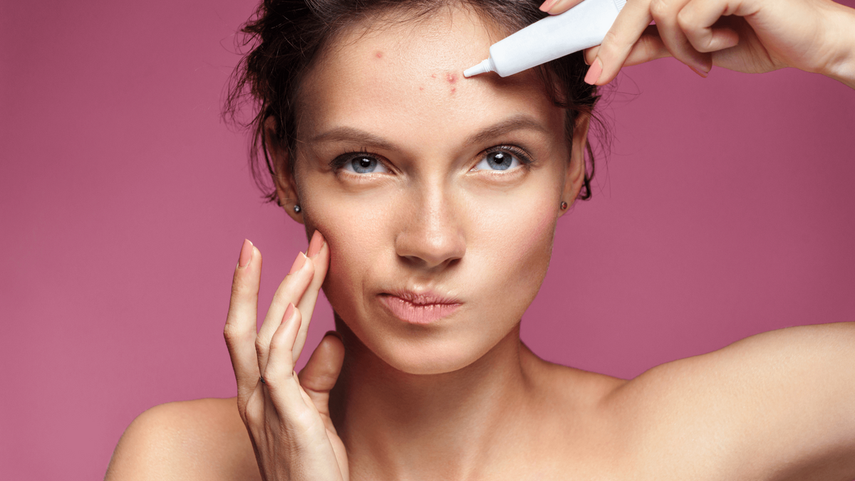 Understanding Acne: Pt1